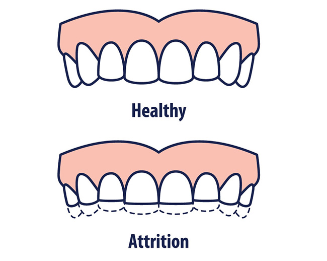 Dental Implants Dentist in Brentwood