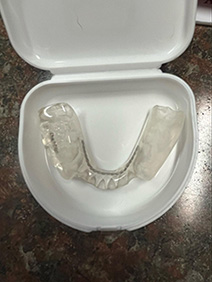 Dental Implant Restorations East Islip